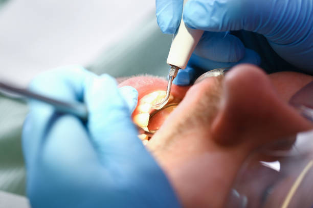Best Emergency Treatment for Oral Infections in Powderly, TX
