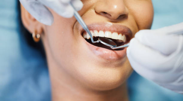 Best Emergency Denture Repair in Powderly, TX